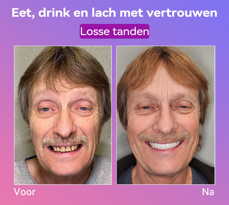 Jasseemยฎ Volgende Generatie Comfortabele Kunstgebit