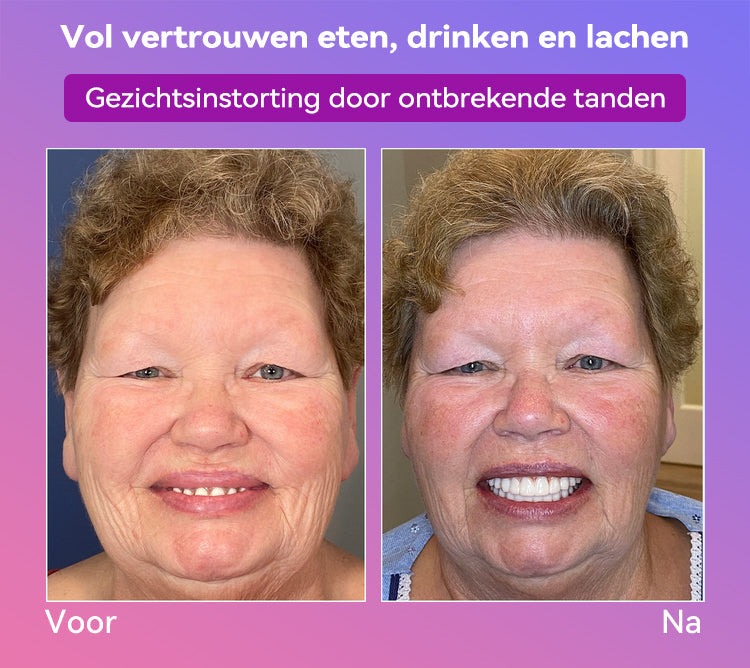 Jasseemยฎ Volgende Generatie Comfortabele Kunstgebit