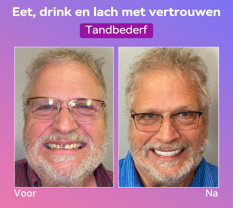 Jasseemยฎ Volgende Generatie Comfortabele Kunstgebit