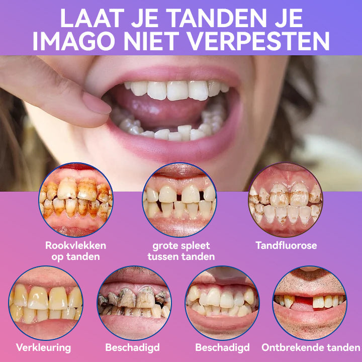Jasseemยฎ Volgende Generatie Comfortabele Kunstgebit