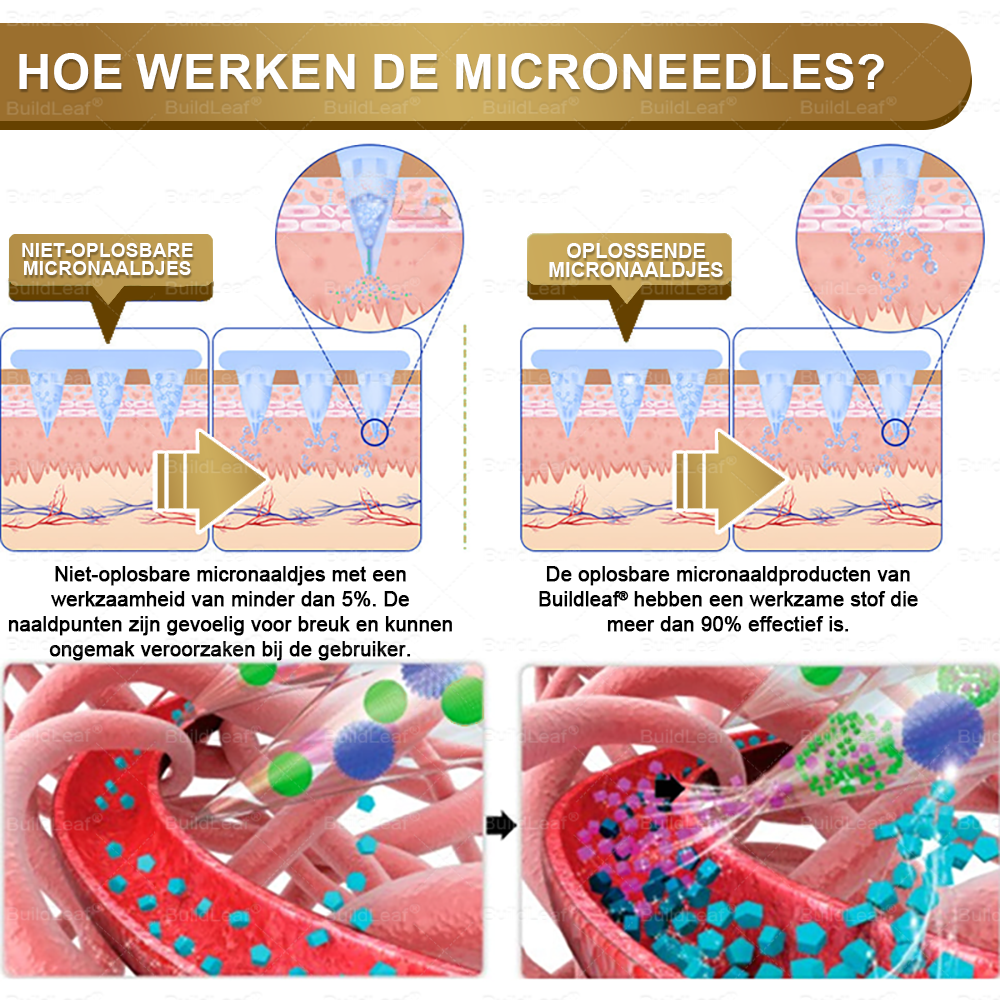 BuildLeaf® NIDDK-Tirzepatide Afslank & Gezondheid Nano Microneedle Patch