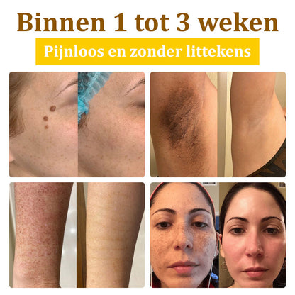 Flysmus™ Behandelingscrème Met Bijengif