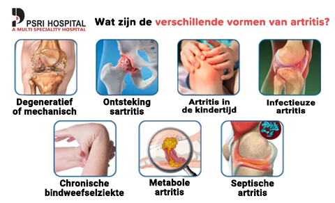 Bijengif Geavanceerde Gewrichts- en Bottherapie Crème