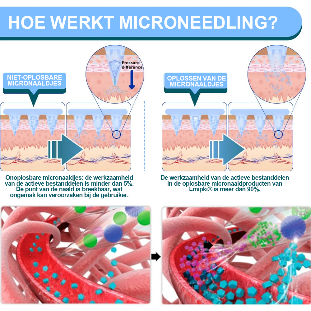 Lmipki® NIDDK-Tirzepatide Nano Microneedle Pleister