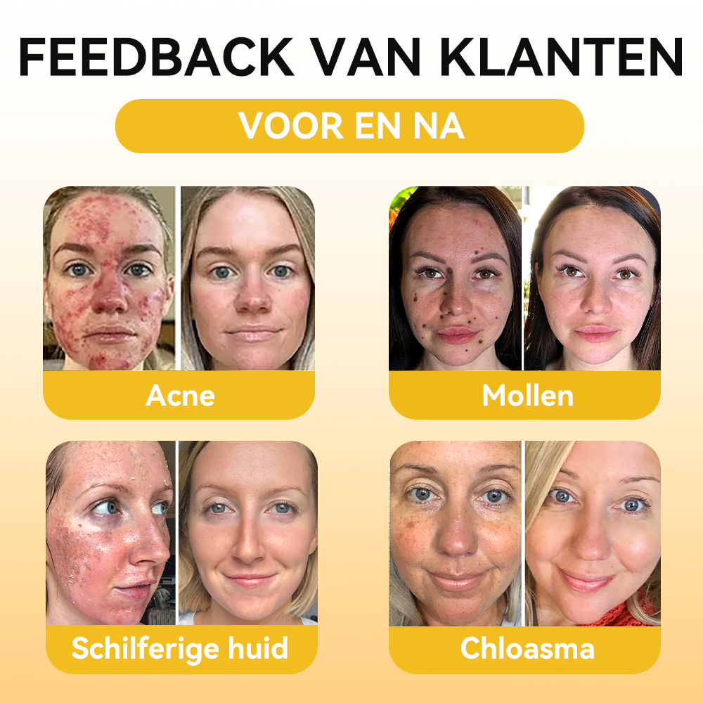 FATONG® Bijengif Huidverzorgingsserum Ampul