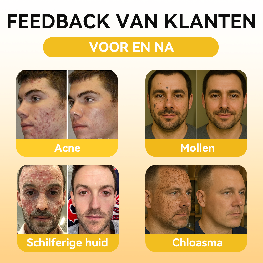 FATONG® Bijengif Huidverzorgingsserum Ampul
