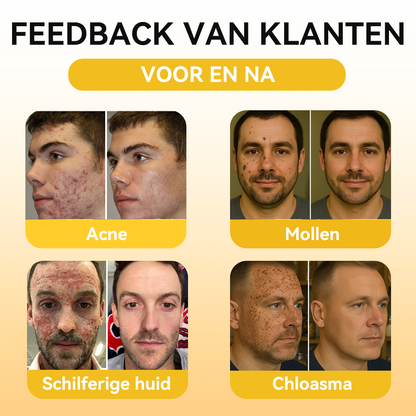 FATONG® Bijengif Huidverzorgingsserum Ampul