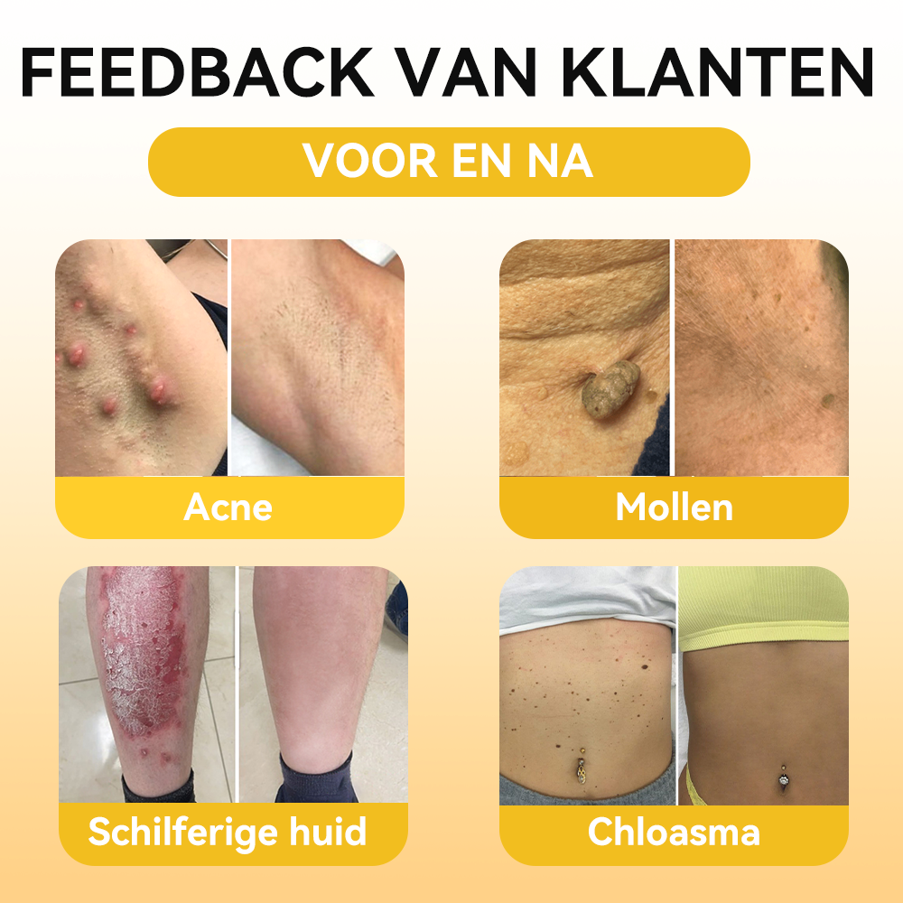 FATONG® Bijengif Huidverzorgingsserum Ampul