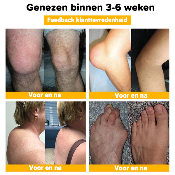 Bijengif Geavanceerde Gewrichts- en Bottherapie Crème