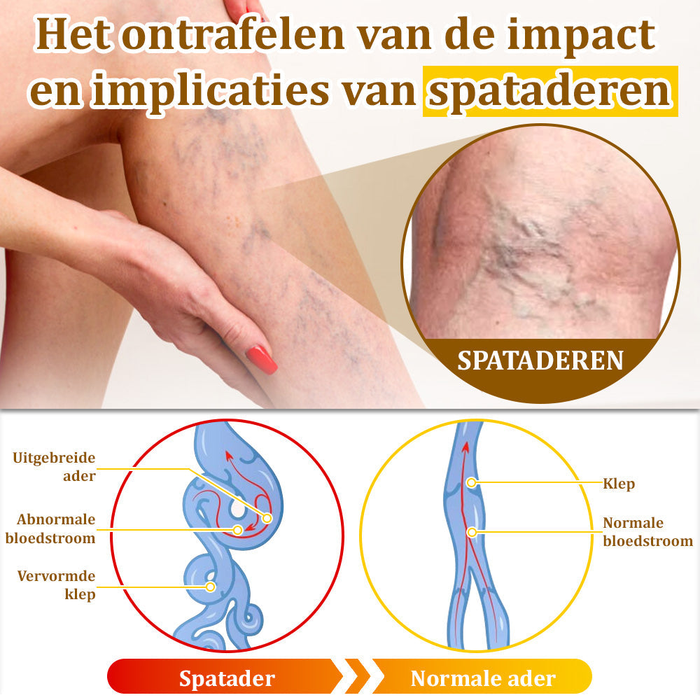 Flysmus™ Behandelingscrème Met Bijengif