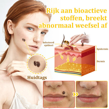Flysmus™ Behandelingscrème Met Bijengif