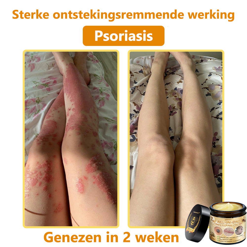 Lenaro® Alles-in-één Huidherstellende Crème