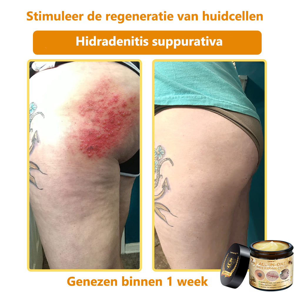 Lenaro® Alles-in-één Huidherstellende Crème