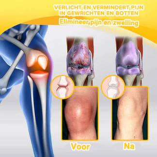 Bijengif Geavanceerde Gewrichts- en Bottherapie Crème