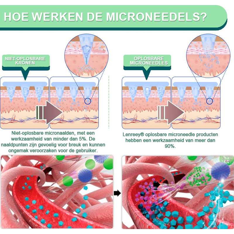 Lenreey® NIDDK-Tirzepatide Nano Microneedle Patch