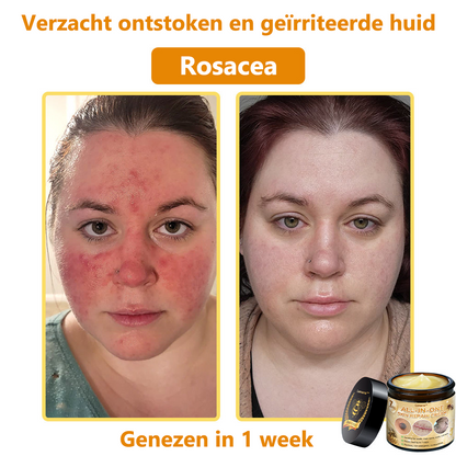 Lenaro® Alles-in-één Huidherstellende Crème
