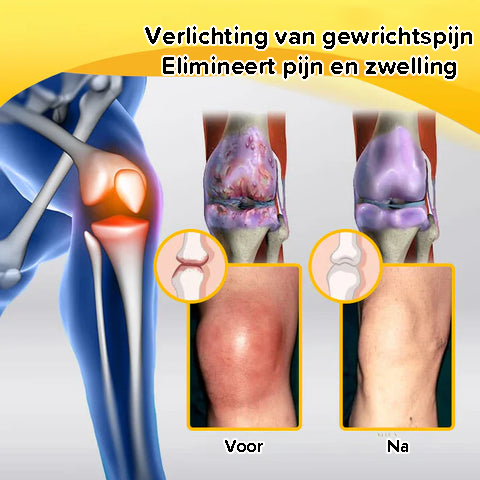 Bijengif Pijnstillende Botgenezende Crème