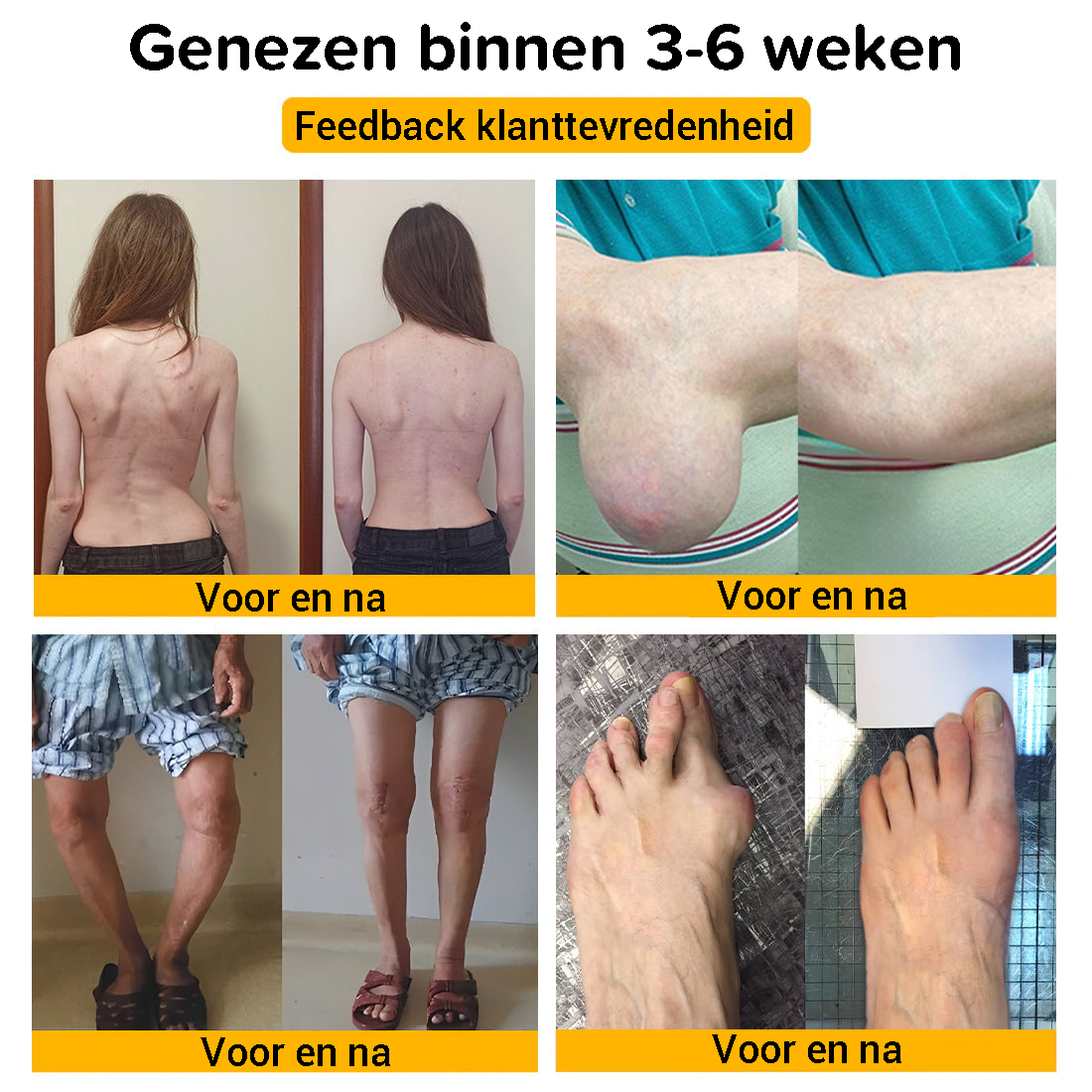 Bijengif Pijnstillende Botgenezende Crème