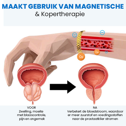 Magnetische koperen prostaatband