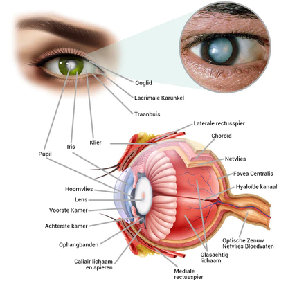 OphthalPro zichtverbeteringsapparaat