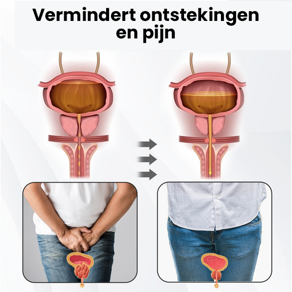 ProstaPower Magnetische Koperen Polsband