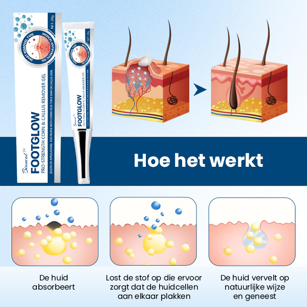 FootGlow Pro-Strength Eelt- en likdoornverwijderaar gel