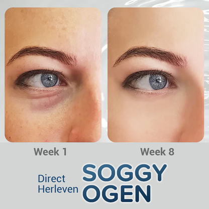 DERMA+ Firm Peptide Verstevigende Ooggel (Koop 1 krijg 1 gratis)