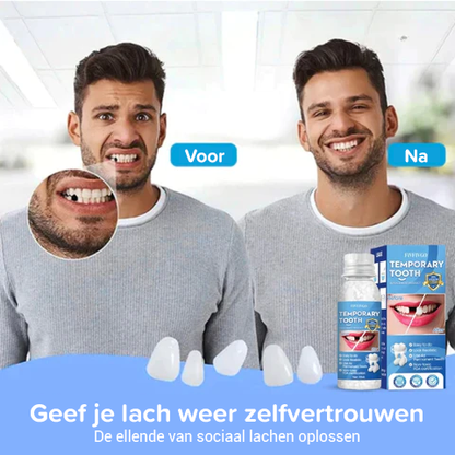 Glory Smile Tijdelijke Tandbeeldhouwer Reparatieset