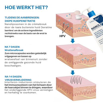 Oveallgo® NanoLipo HPV Genitale Wratten Verwijdercrème