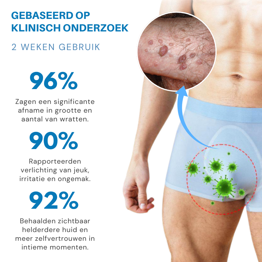 Oveallgo® NanoLipo HPV Genitale Wratten Verwijdercrème