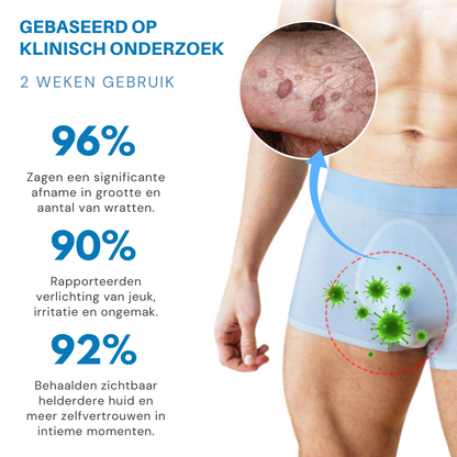 Oveallgo® NanoLipo HPV Genitale Wratten Verwijdercrème