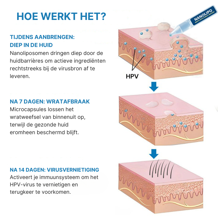 Oveallgo® NanoLipo Genitale Wratten Klinische Ampullen