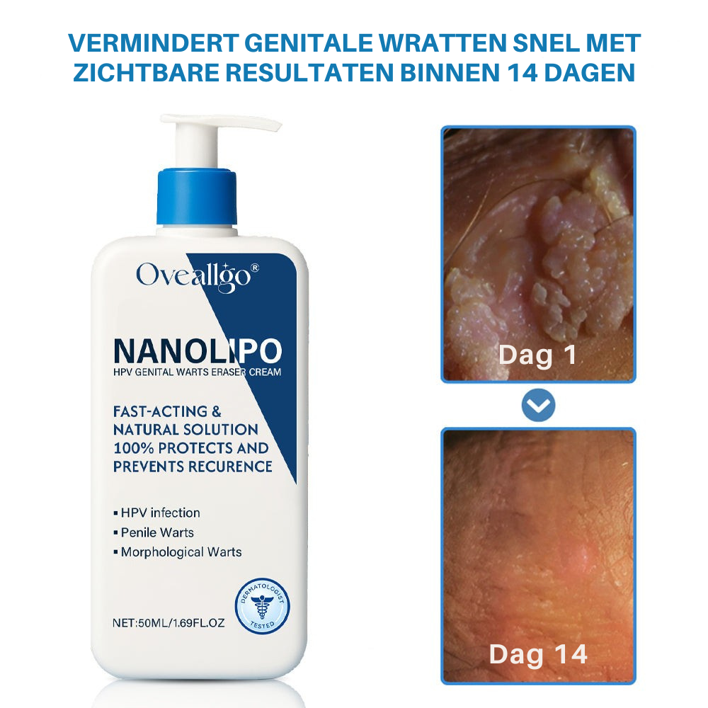 Oveallgo® NanoLipo HPV Genitale Wratten Verwijdercrème