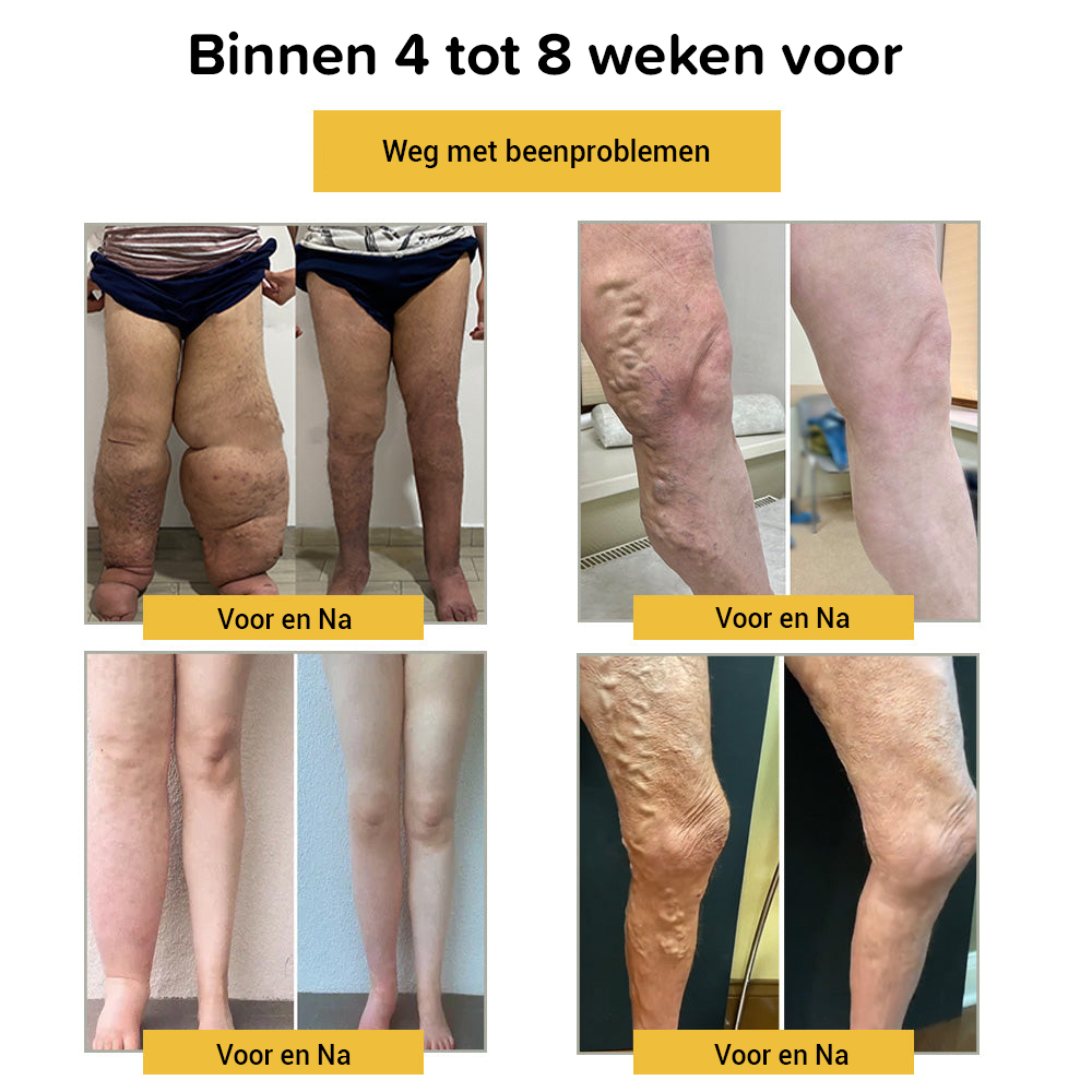 Bijengif lymfedrainage en afslanken voetbad kralen (7 stuks)