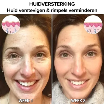 Botox gezichtsserum