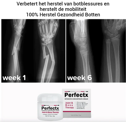 Perfectx Gewrichts- en Bottherapiecrème