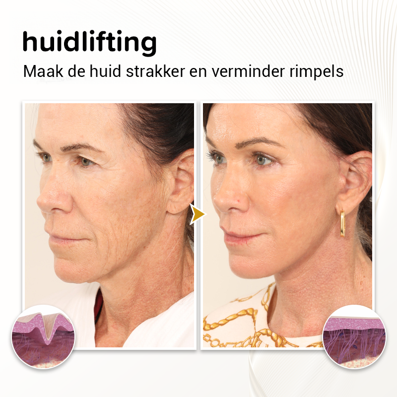 DermRejuv huidverstevigend Serum