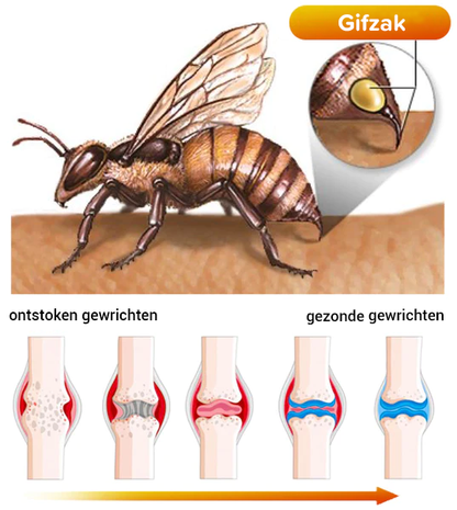 Nieuw-Zeelandse bijengif gewrichts- en bottherapie geavanceerde crème