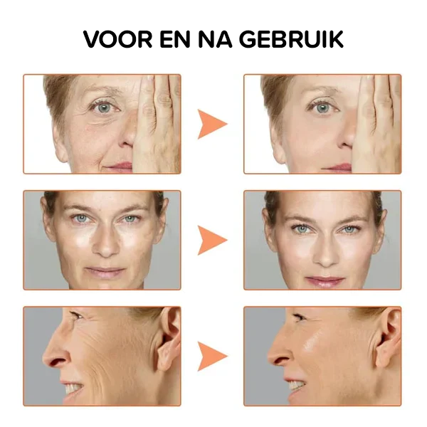 Botox gezichtsserum