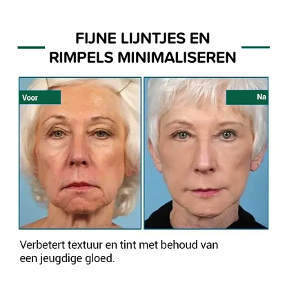 Botox gezichtsserum