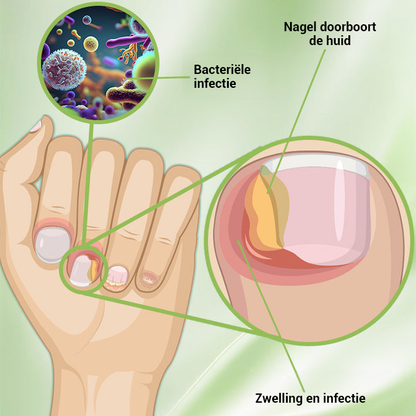 FungiFix Nagelschimmel Voedende Behandeling Vloeibaar