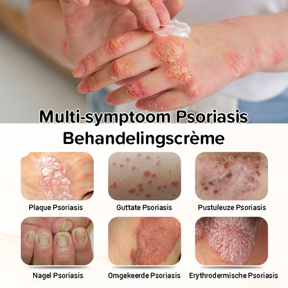 Psoriasis antibacteriële crème