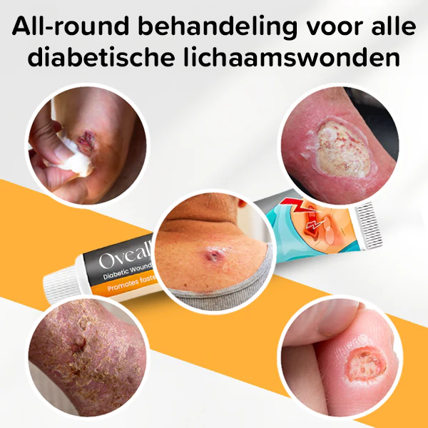 Crème voor behandeling van diabetische wonden