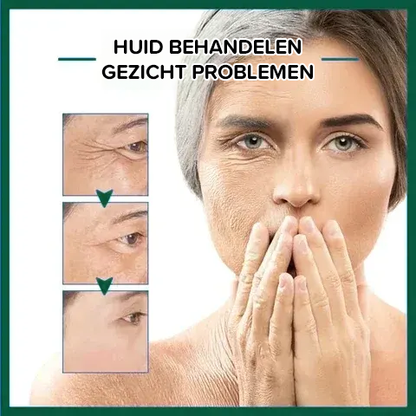 Botox gezichtsserum