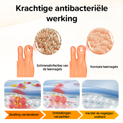 Psoriasis antibacteriële crème