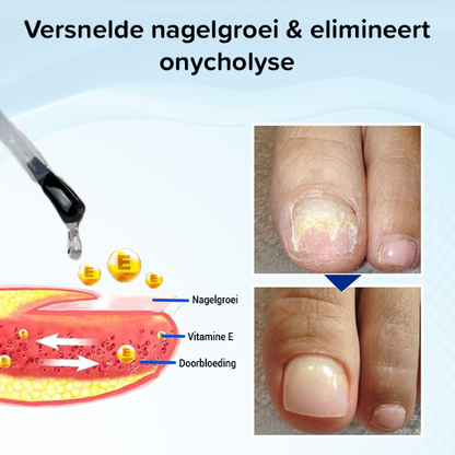 OnyxoGuard nagelgroei- en herstelserum