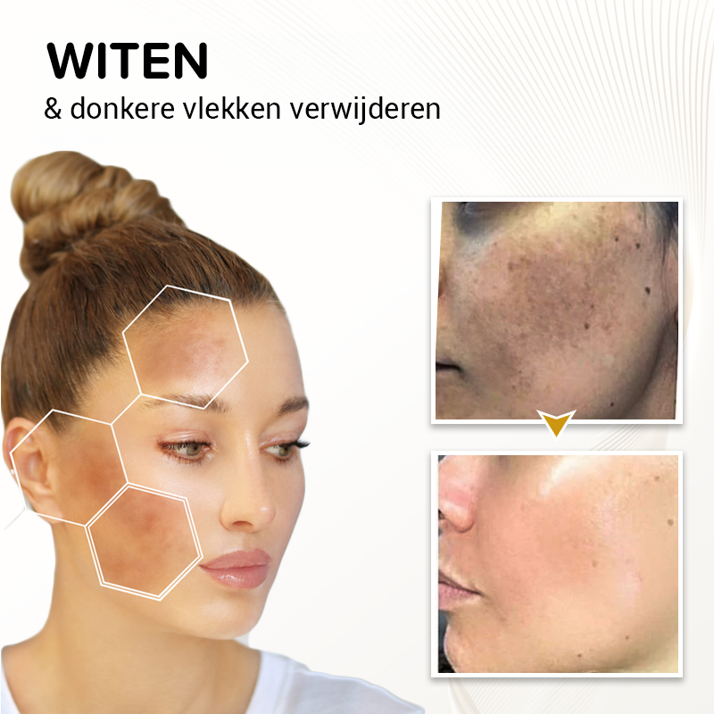 DermRejuv huidverstevigend Serum