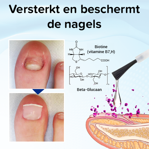 OnyxoGuard nagelgroei- en herstelserum