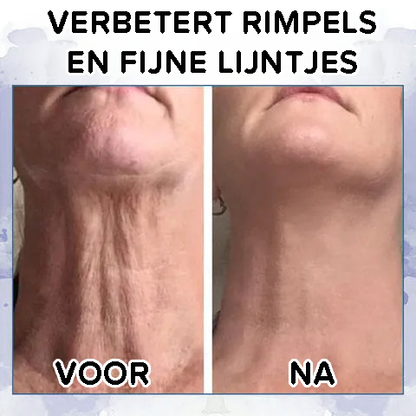 Geavanceerde verstevigende en rimpelverminderende crème