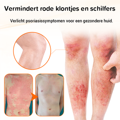 Psoriasis antibacteriële crème